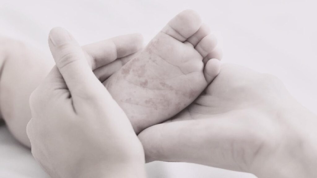 Aumenta a 22 el número de casos de sarampión en Tomatlán; intensifican medidas en la zona